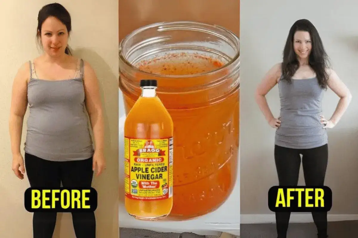 Antes y despu&eacute;s de usar vinagre de manzana. Considera las contraindicaciones del vinagre de manzana antes de empezar.